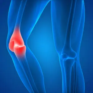 Kneeconditions
